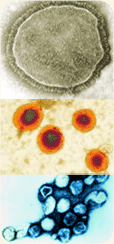 Measles, mumps, and rubella