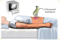 Abdominal ultrasound © 2009 Nucleus Medical Art, Inc.